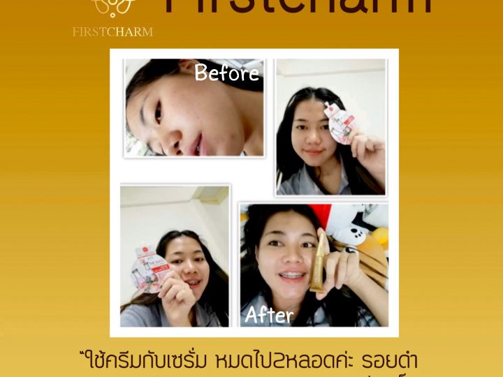 รีวิวจากผู้ใช้จริง เซรั่ม คู่กับครีม