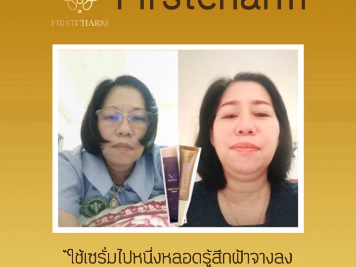 ใช้เซรั่ม ลดฝ้า หน้าใส