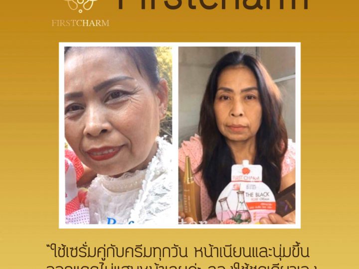 รีวิวผู้ใช้จริงเซรั่มคู่ครีม