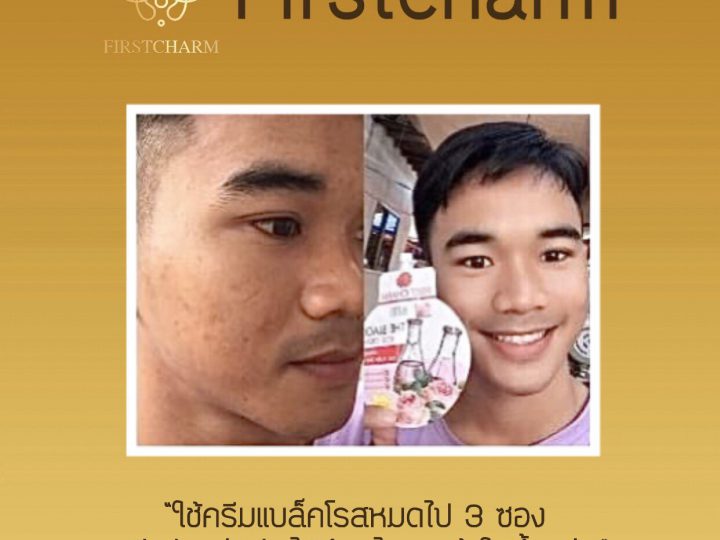 รีวิวจากผู้ใช้จริง ครีมแบล็คโรส