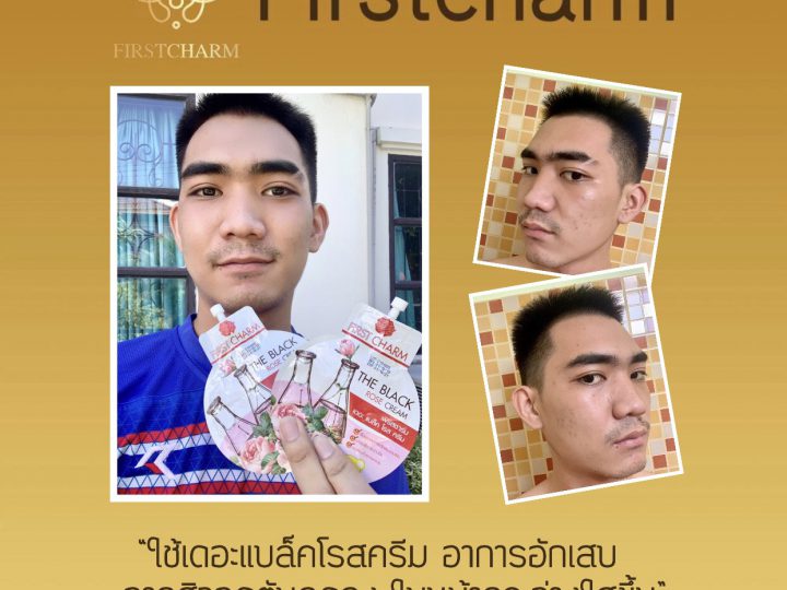 รีวิวจากผู้ใช้จริง ครีมแบล็คโรส