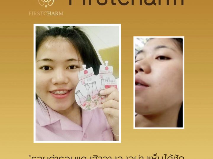 รีวิวจากผู้ใช้จริง ครีมแบล็คโรส